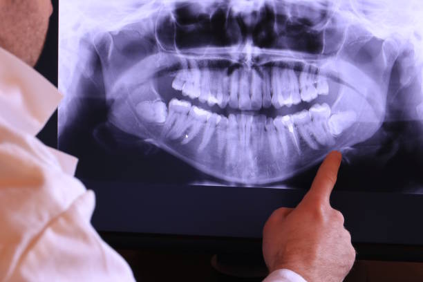 Best Emergency Dental Care for Broken or Chipped Teeth in Scobey, MT